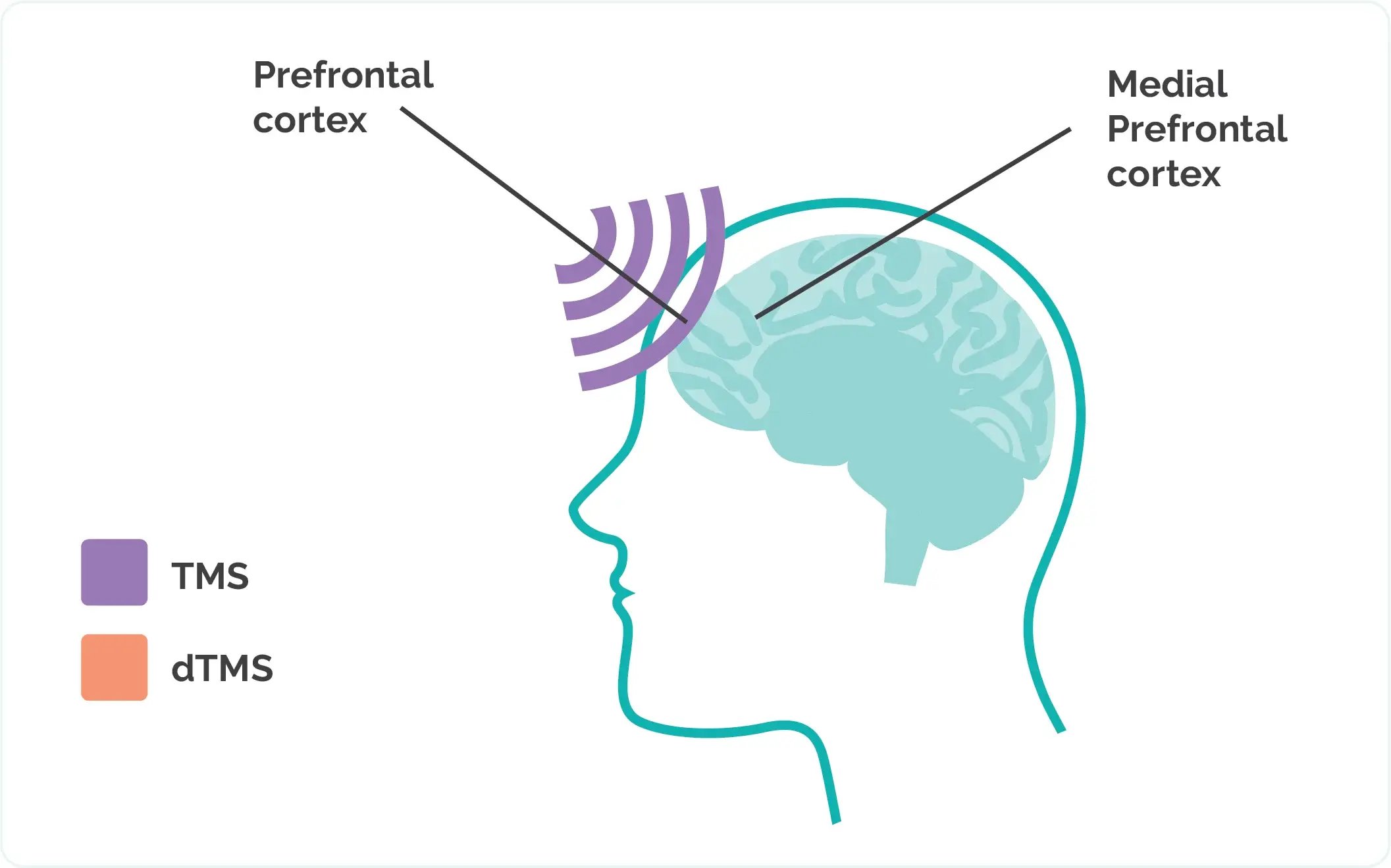 workers compensation mental health TMS therapy Work-related mental health claims TMS for workers' compensation Workers' compensation benefits for TMS Mental health in workers' compensation cases